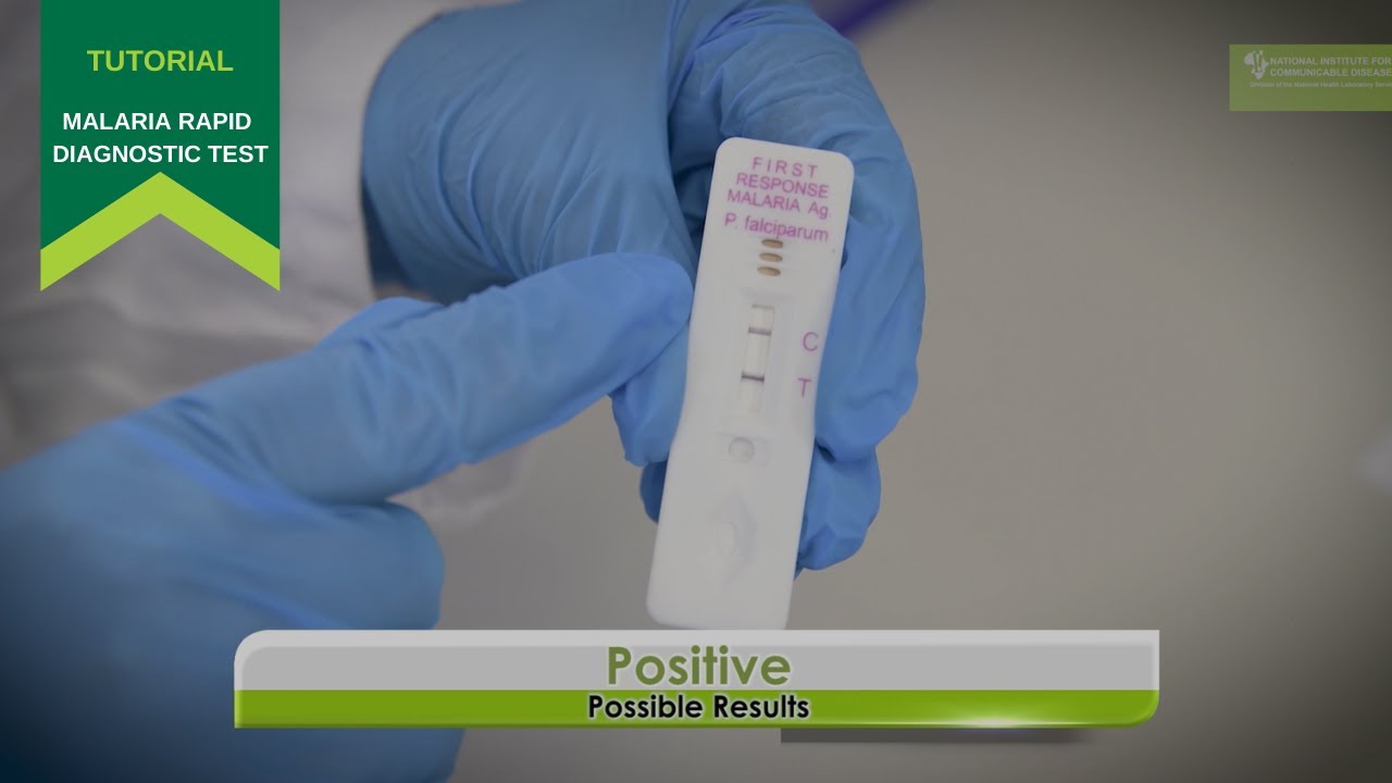 Malaria rapid diagnostic test kit on a clinic table